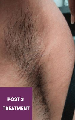 Result Before Treatment