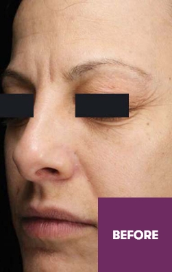 Result Before Treatment