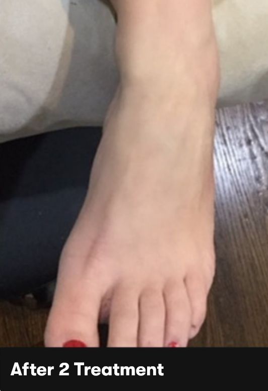 Result After Treatment