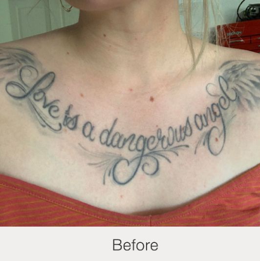 Result Before Treatment