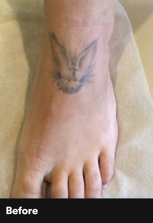 Result Before Treatment