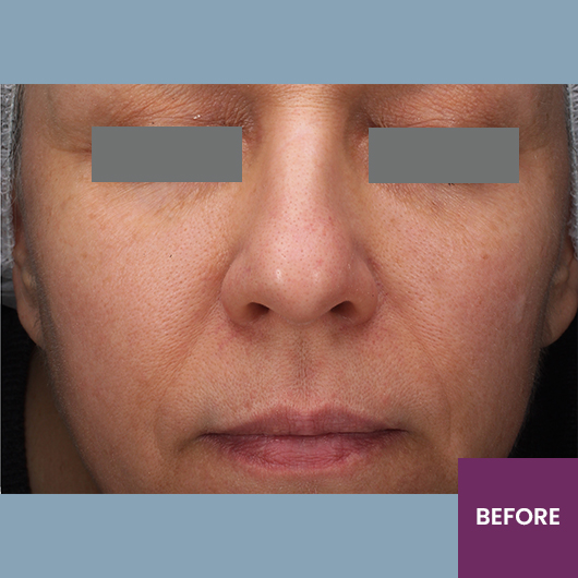 Result Before Treatment
